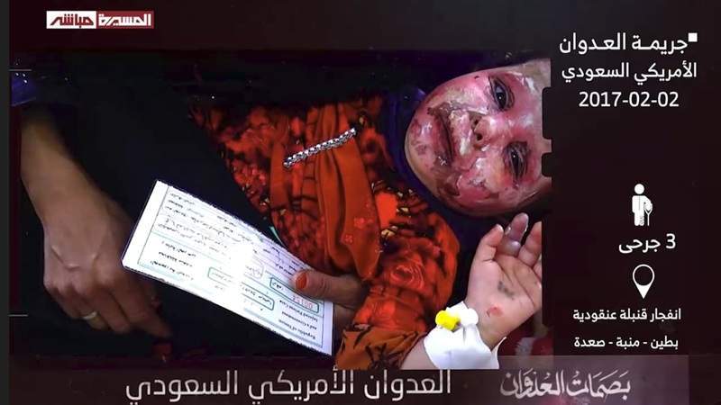 Feb. 2 Over 9 Years: 16 Casualties in US-Saudi War Crimes on Yemen