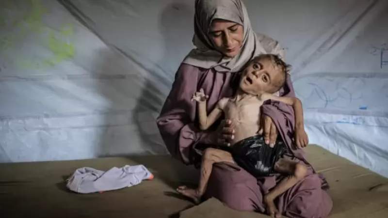 Starvation Claims 5 Lives in Gaza, Including Two Children — Humanitarian Crisis Deepens