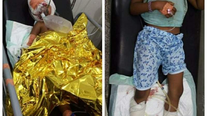 UN Participates in Killing Yemeni People by Politicizing Cluster Bombs Aid