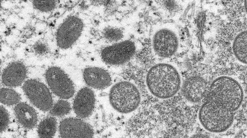 Europe, US on Alert after Rare Monkeypox Virus Outbreak