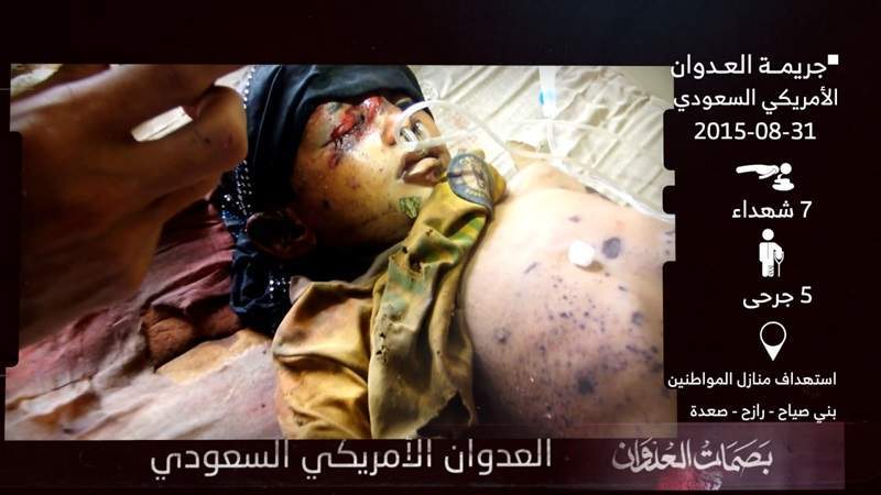 August 31 Over 9 Years: Bloody Anniversary - Airstrikes Claim Lives, Injure Civilians, and Destroy Yemen's Infrastructure
