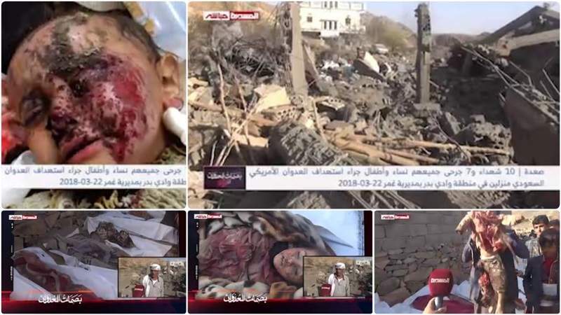 March 22 Over 9 Years: 17 Casualties, Displacement in  US- Saudi Aggression Crimes on Yemen