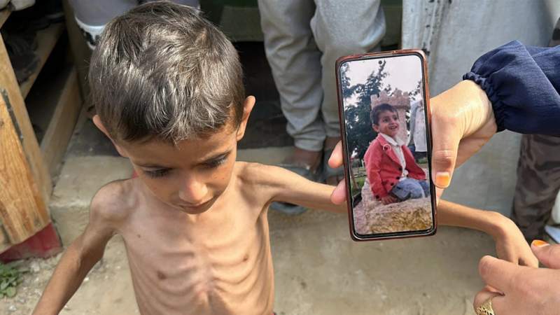 WHO Trucks with Medical Aid Must Be Allowed into Gaza: Official