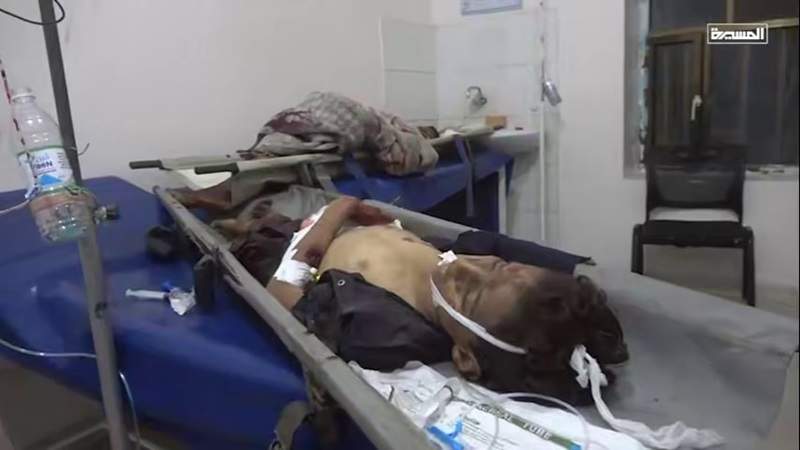 Five Children Killed in Artillery Strike by Mercenaries in Occupied Taiz