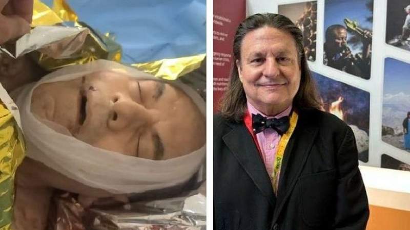 Suspicious Silence of UN over Assassination of its Worker in Saudi- Occupied Taiz