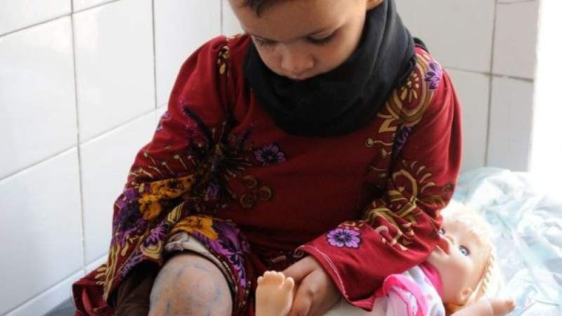 ICRC: About 4.5 Million People in Yemen Suffer from Disabilities due to War