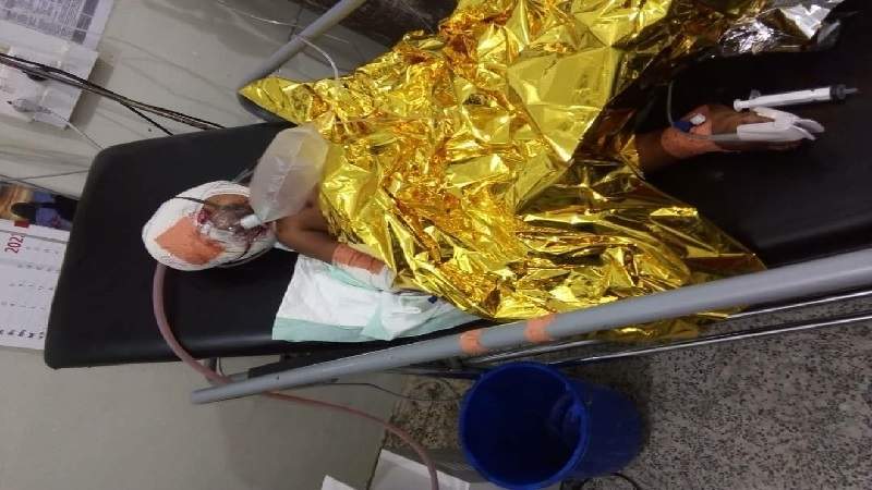 Three Kids Injured in US-Saudi Remnant Cluster Bomb, in Hajah