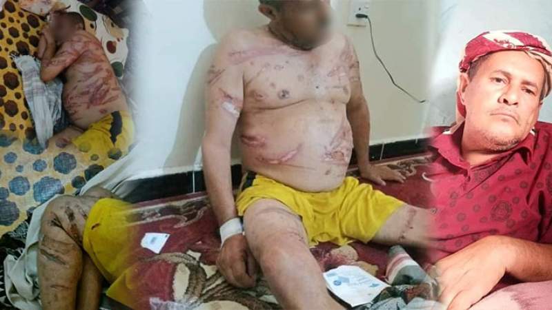 US-Saudi Mercenaries in Abyan Admit Crime of Killing Citizen in Cold Blood