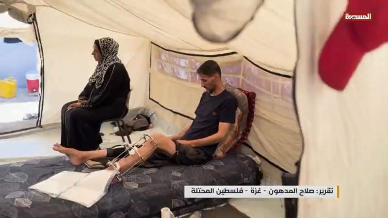 Wounded in Gaza: The War of Pain Continues Despite the Halt in Bombing