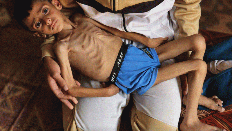 Gaza’s Children Struggle to Find One Meal Daily ‘If Lucky’, Says UNICEF