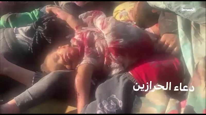 Martyrs and Injuries, Including Women and Children, in Israeli Enemy Strike on Civilians in Central Deir al-Balah