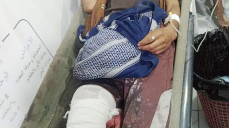 Four Civilians Injured by Saudi Enemy's Gunfire in Sa'adah