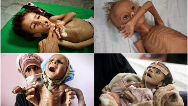 Shocking Extent of US-Saudi Blockade on Yemen, Deepening Worst Humanitarian Crisis
