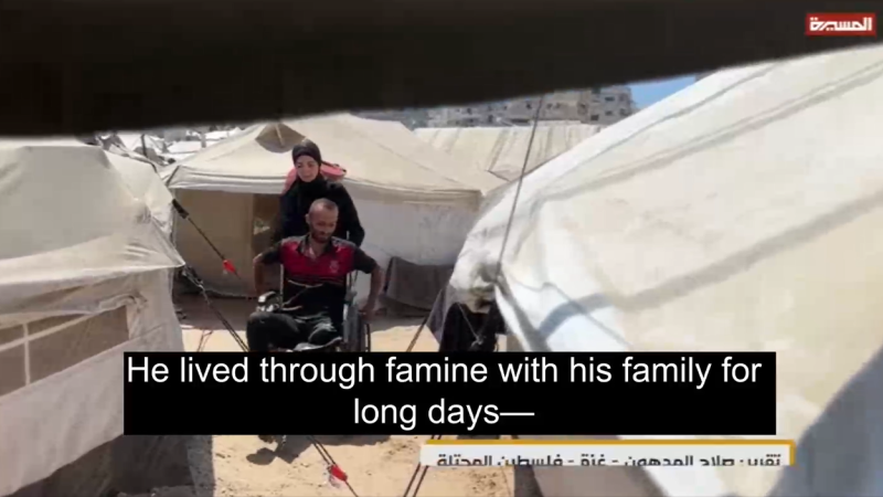 From Hunger to Amputation:  Seeking Food Becomes a Death Sentence in Gaza
