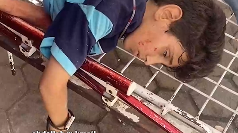 Wounded Child Lies on a Bed Without a Mattress in Gaza as Zionist Siege Tightens and Medical Supplies Run Dry