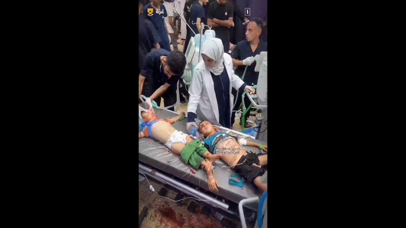 Children Seriously Injured in Zionist Bombing of Displaced Persons’ Tents in Al-Mawasi, West of Khan Younis