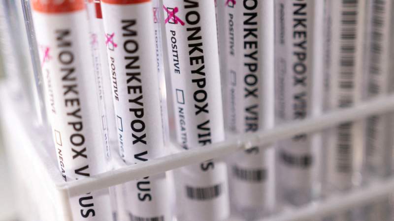 Experts: US at Risk of Losing Control Over Monkeypox As Cases Rise