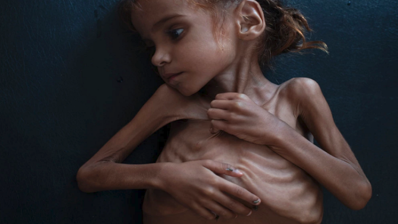 UN-Sponsored Truce Fails to Improve Worst Humanitarian Crisis in Yemen?