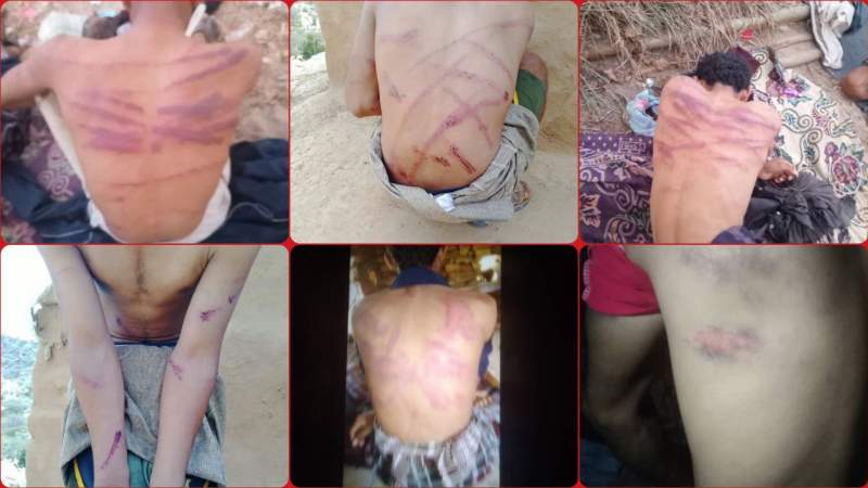 Human Rights Group: Saudi Torture and Killings of Yemeni Detainees Constitute War Crimes