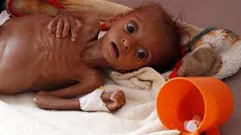 The Guardian: Yemen on Brink of Losing Entire Generation of Children to Hunger, UN Warns