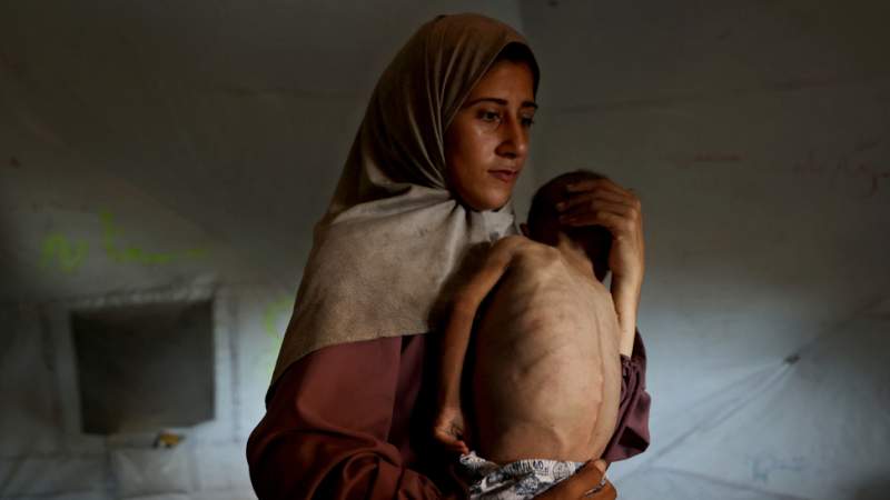 All Children Under Five in Gaza at Risk of Malnourishment, UN Warns