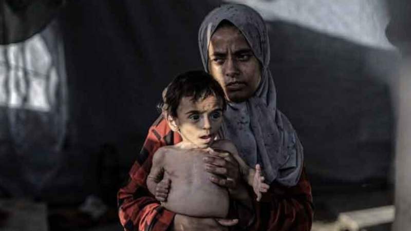 Malnutrition and Starvation Kills 21 Palestinian Children in Past 72 Hours