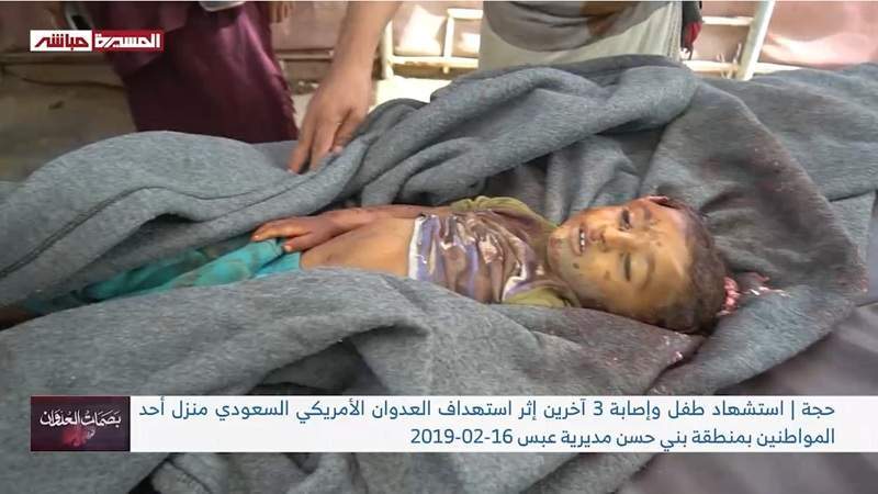 Feb. 16 Over 9 Years: 16 Casualties in War Crimes in Yemen
