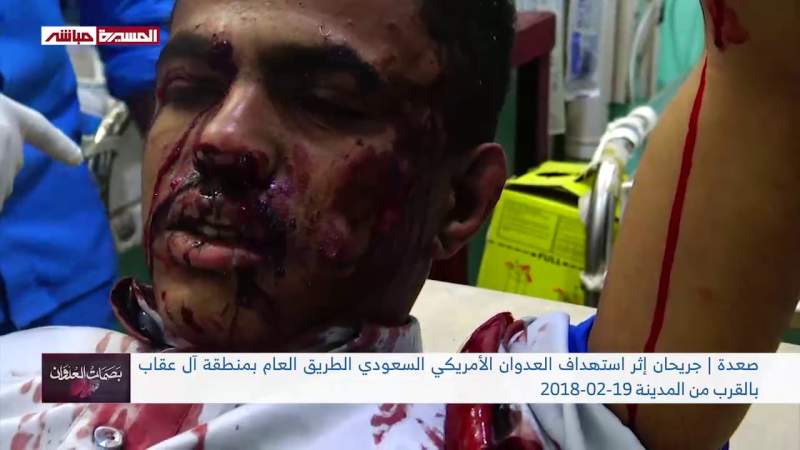 Feb. 19 Over 9 Years: 9 Injured in US-Saudi War Crimes Targeting Yemeni Homes and Properties