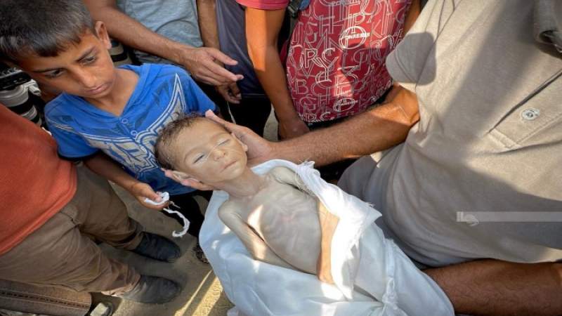 Starvation Crisis in Gaza Worsens: 251 Dead, Including 108 Children