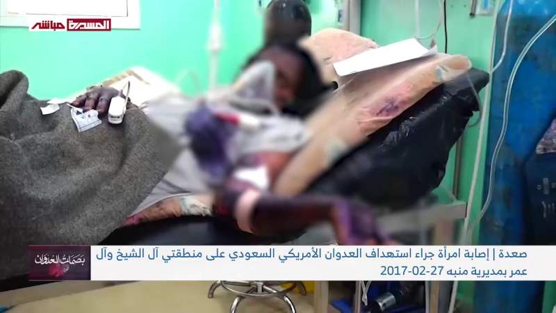 Feb. 27 Over 9 Years: 120 Casualties in US-Saudi Aggression on Yemen